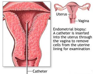 ENDOMETRIAL