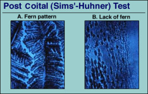 postcoital