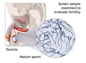 semenanalisis